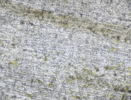 A close-up view of a thin section of a plant leaf under a microscope. The image shows intricate, interlocking cells that form a mosaic pattern, with some slight variations in size and shape. There are also subtle patches of darker and lighter areas, possibly indicating different cell types or structures within the leaf tissue.