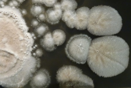 Several circular colonies of mold with a fuzzy texture and white to beige coloration on a dark background. The colonies vary in size, exhibiting a spore-like appearance with some areas showing concentric growth patterns.