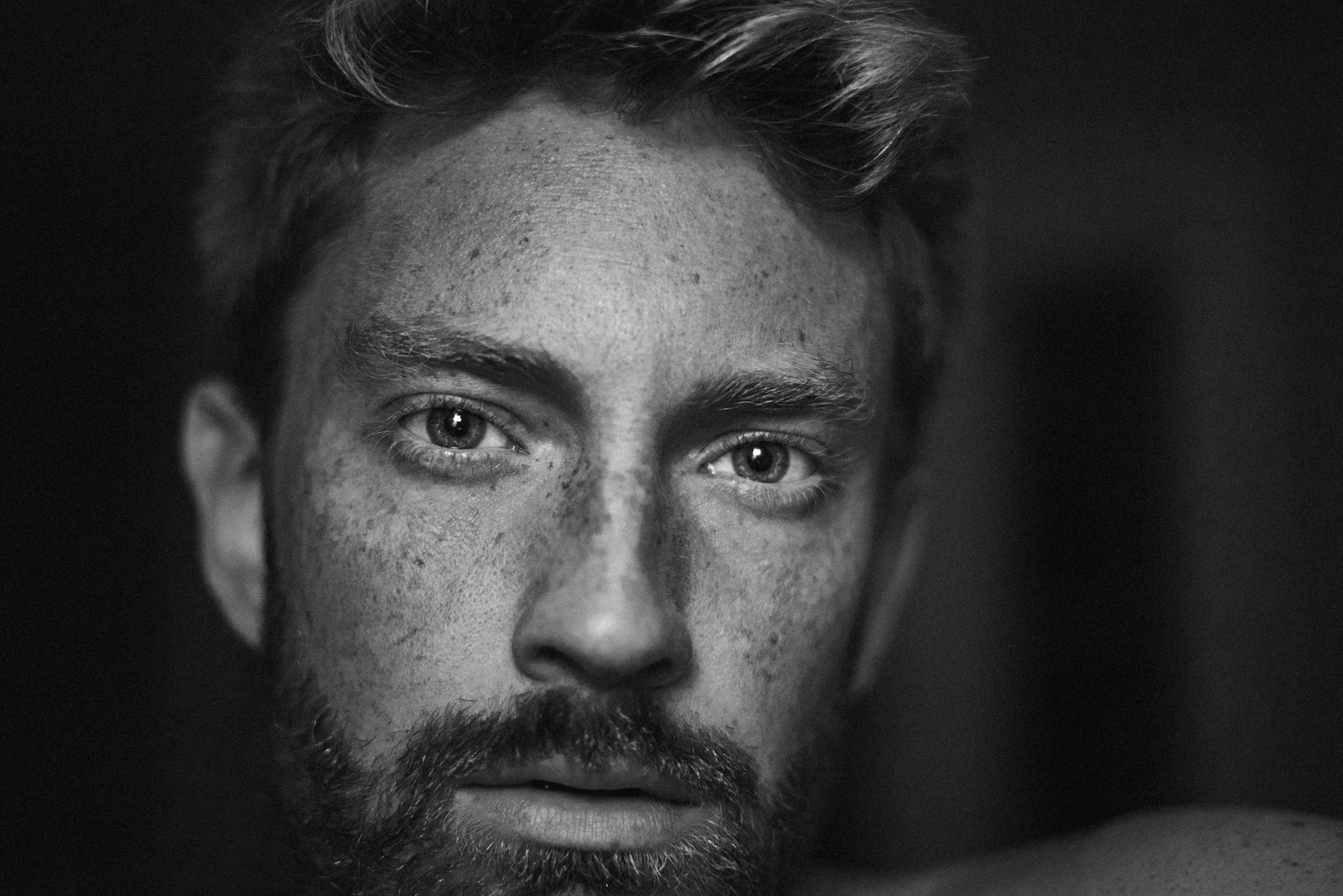 a black and white photo of a man with freckled hair
