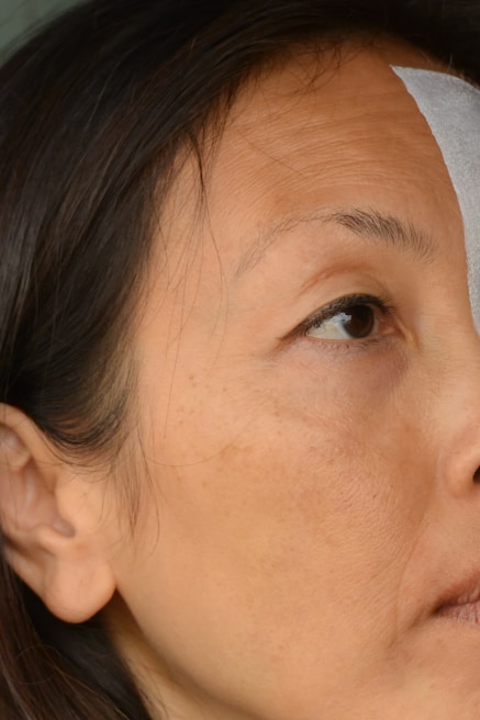 Close-up of a patient’s scalp revealing improved skin texture and reduced dandruff.