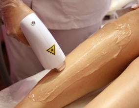 a woman getting a laser on her leg