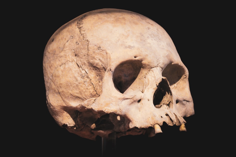 a human skull on a black background