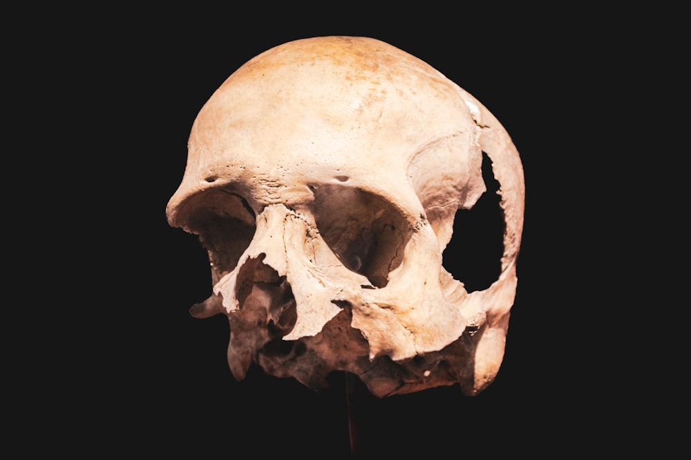 a close up of a human skull on a black background