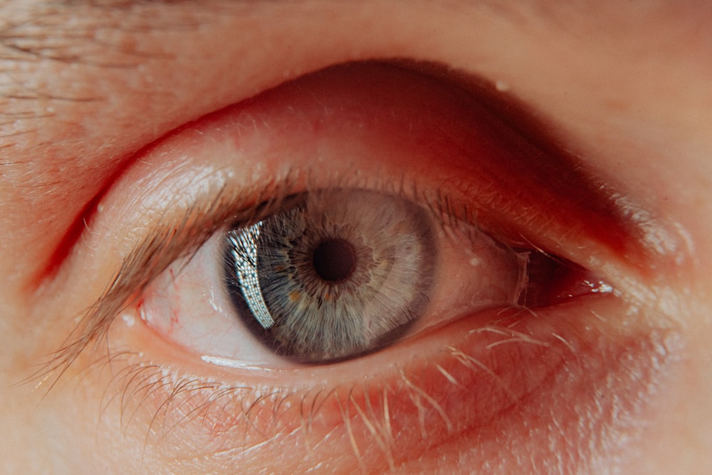 a close up of a person's eye with a red spot on the iris