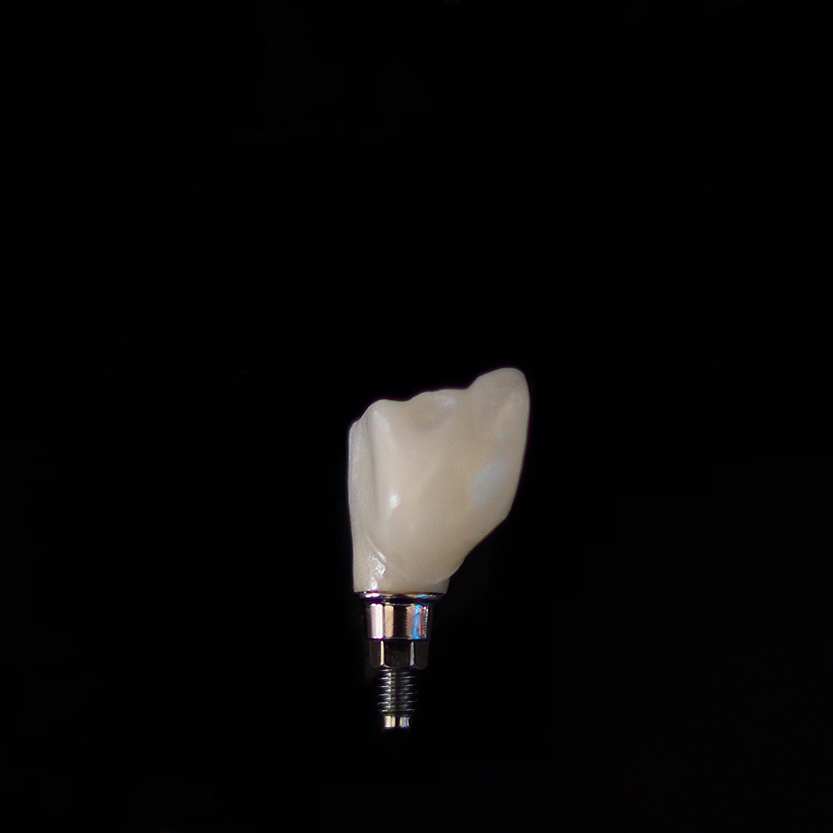 Porcelain veneers