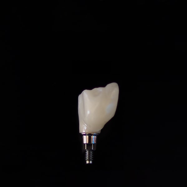 Implants & Oral Surgery