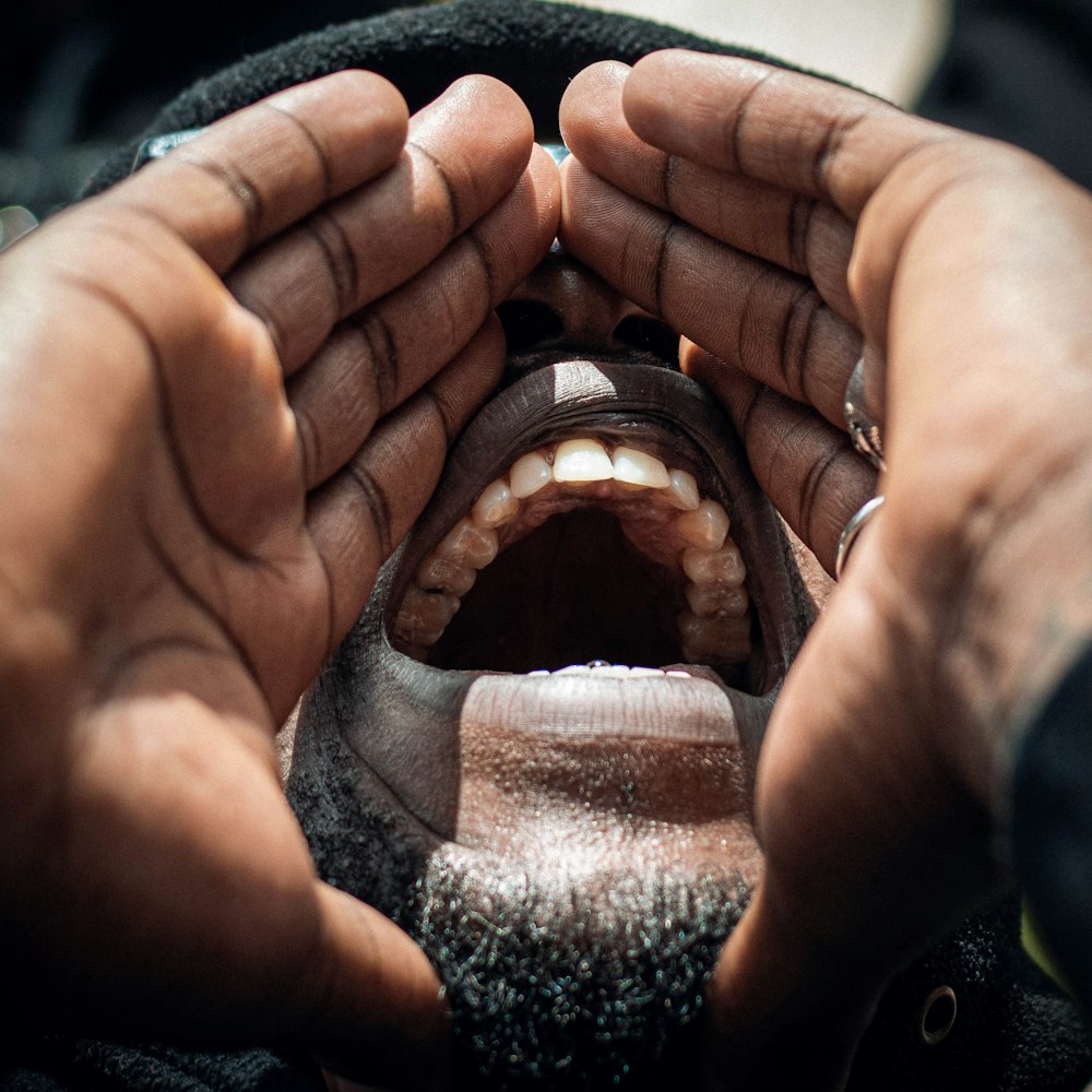 a person holding their hands open to show the inside of their mouth