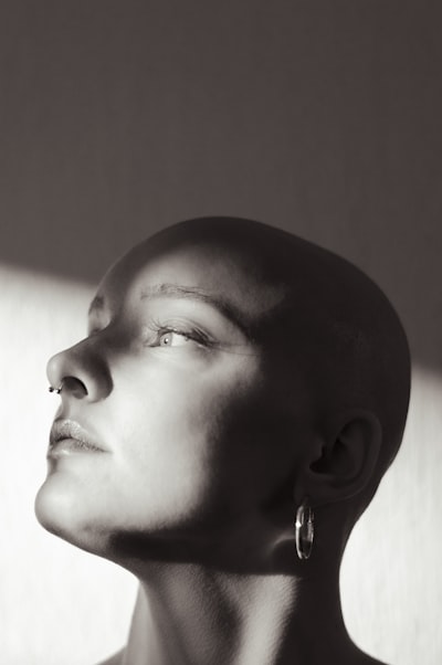 After Alopecia Diagnosis: Coping Strategies in Boston