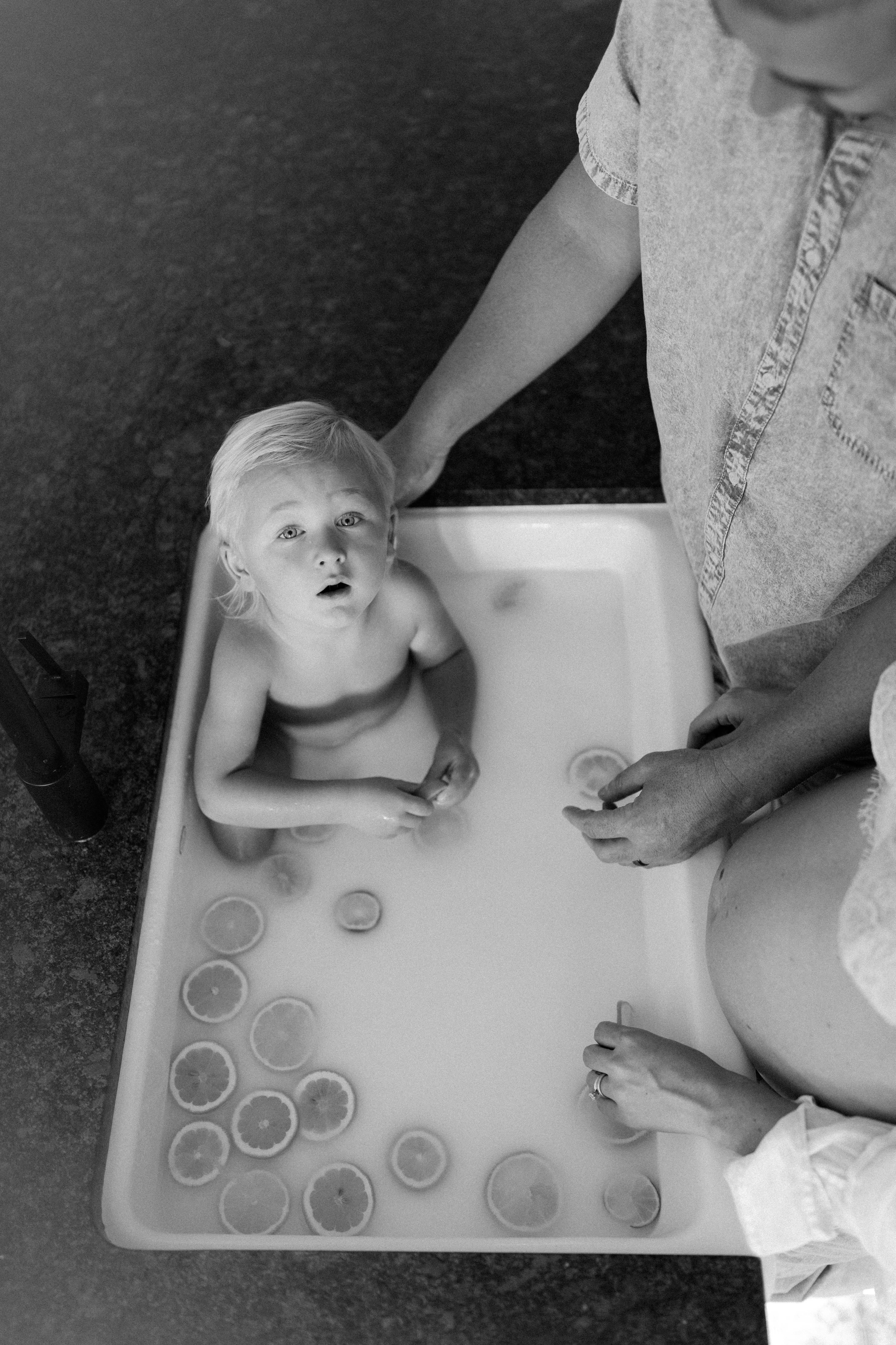 The Benefits of Using Bleach Baths for Eczema Relief