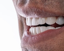 A close-up of a person&rsquo;s mouth showing a healthy set of white teeth and pink lips. The skin texture and pores around the mouth are visible, indicating a zoomed-in view.