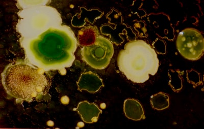 Clusters of variously shaped and colored microbial colonies appear on a dark surface. The textures are varied, with some colonies smooth and others more granular. The colors range from bright green to light yellow and brown, creating a contrast against the dark background.