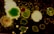 Clusters of variously shaped and colored microbial colonies appear on a dark surface. The textures are varied, with some colonies smooth and others more granular. The colors range from bright green to light yellow and brown, creating a contrast against the dark background.