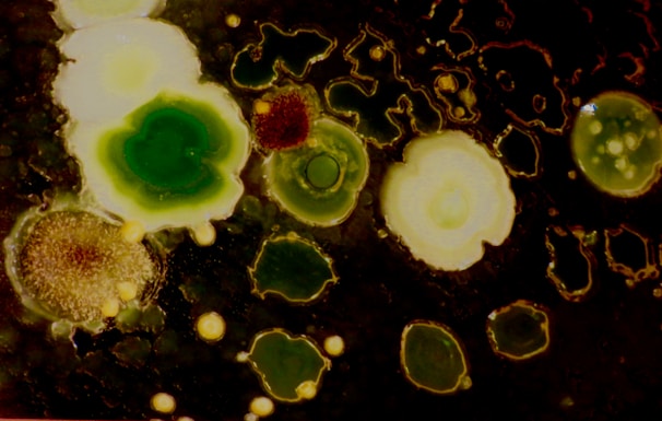 Clusters of variously shaped and colored microbial colonies appear on a dark surface. The textures are varied, with some colonies smooth and others more granular. The colors range from bright green to light yellow and brown, creating a contrast against the dark background.