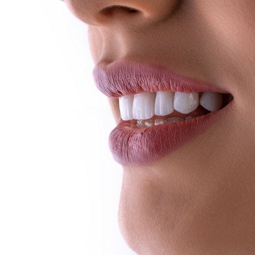 a close up of a woman's mouth with white teeth