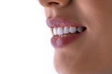 a close up of a woman's mouth with white teeth