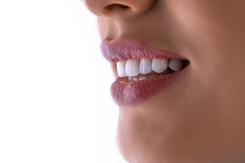 a close up of a woman's mouth with white teeth
