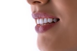 a close up of a woman's mouth with white teeth
