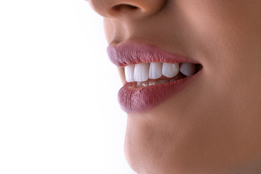 a close up of a woman's mouth with white teeth