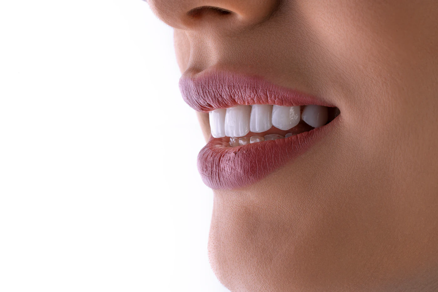 Close-up of a bright, healthy smile