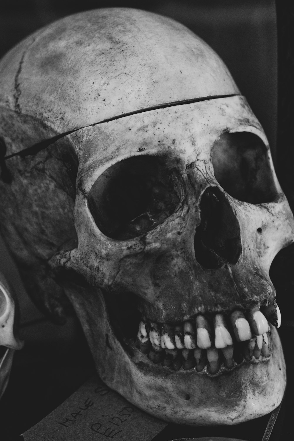 a black and white photo of a human skull