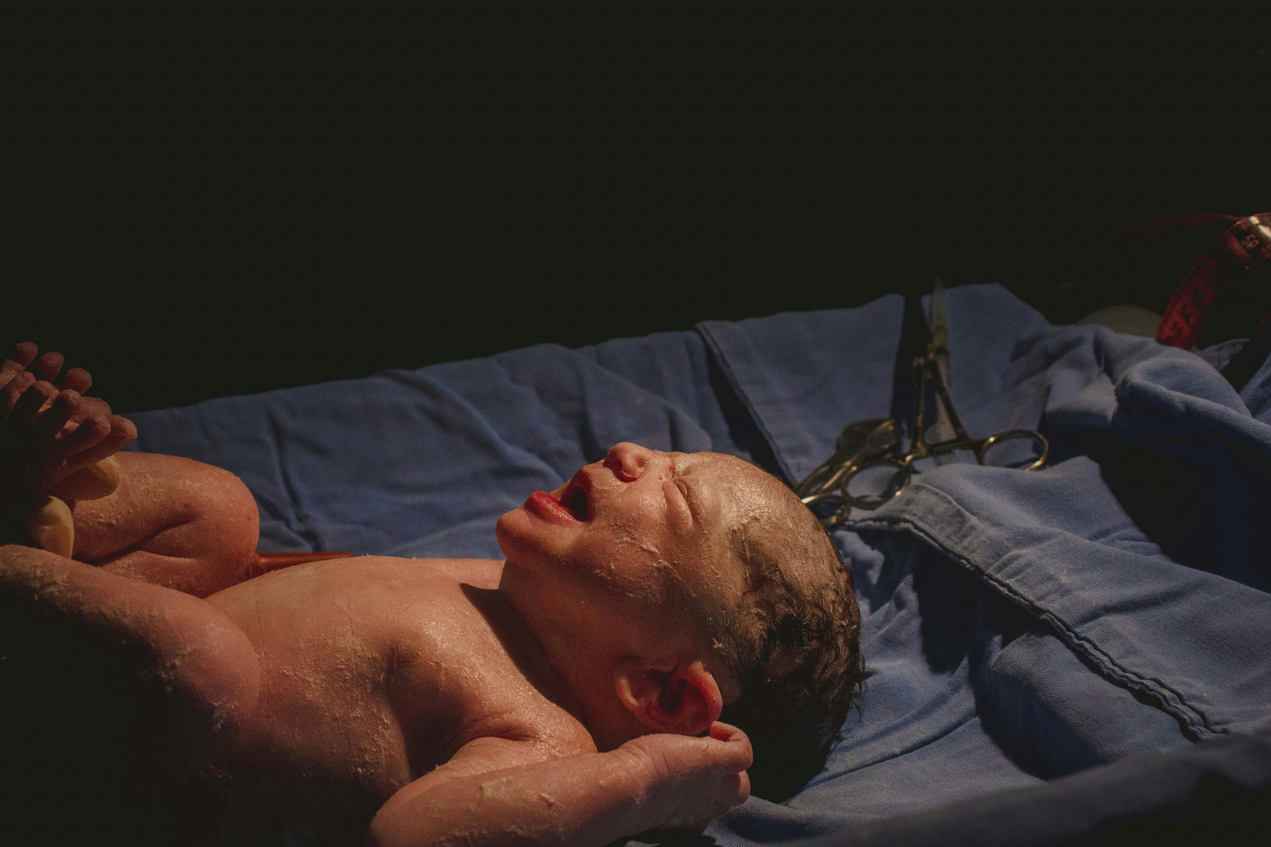 2차 기형아 검사 시기