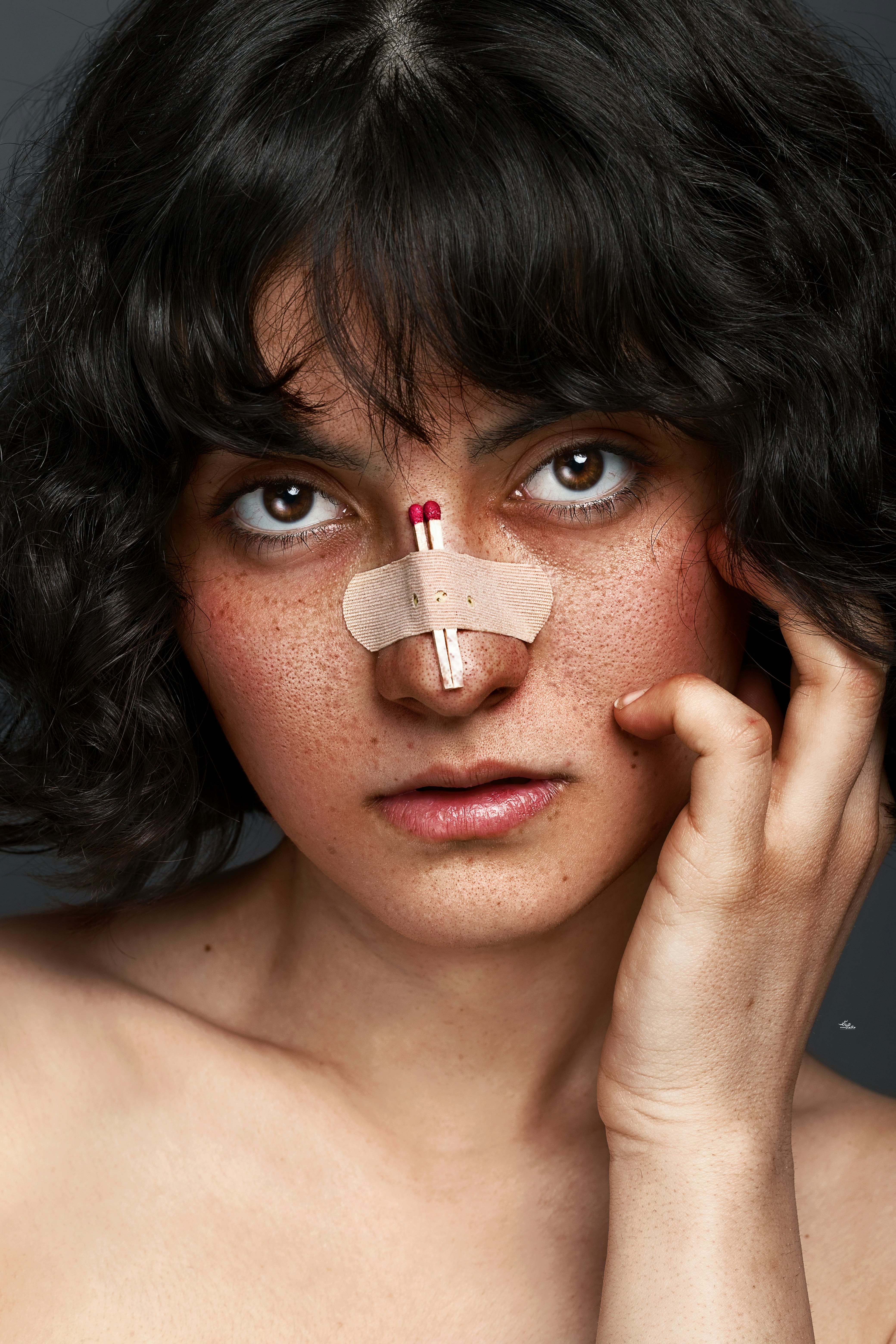 acne patch skincare aesthetic, wallpaper, Best Benzoyl Peroxide Pimple Patch for Cystic Acne: Does It Work? 4