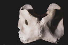Illustration showing healthy bone structure contrasted with osteoporotic bone.
