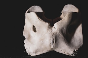 Custom 3D model showcasing a fractured bone for analysis.