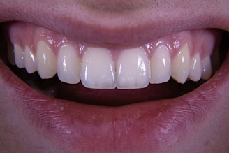 a close up of a person's mouth with a missing tooth