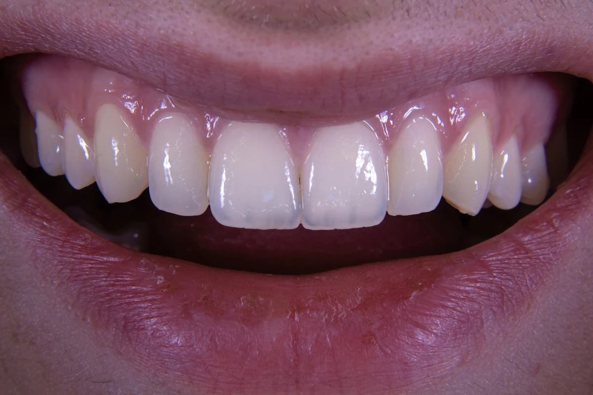 İllüstratif görsel: a close up of a person's mouth with a missing tooth
