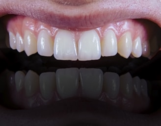 A close-up view of a set of clean, white teeth with healthy gums showing a reflection below.