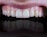 A close-up view of a set of clean, white teeth with healthy gums showing a reflection below.