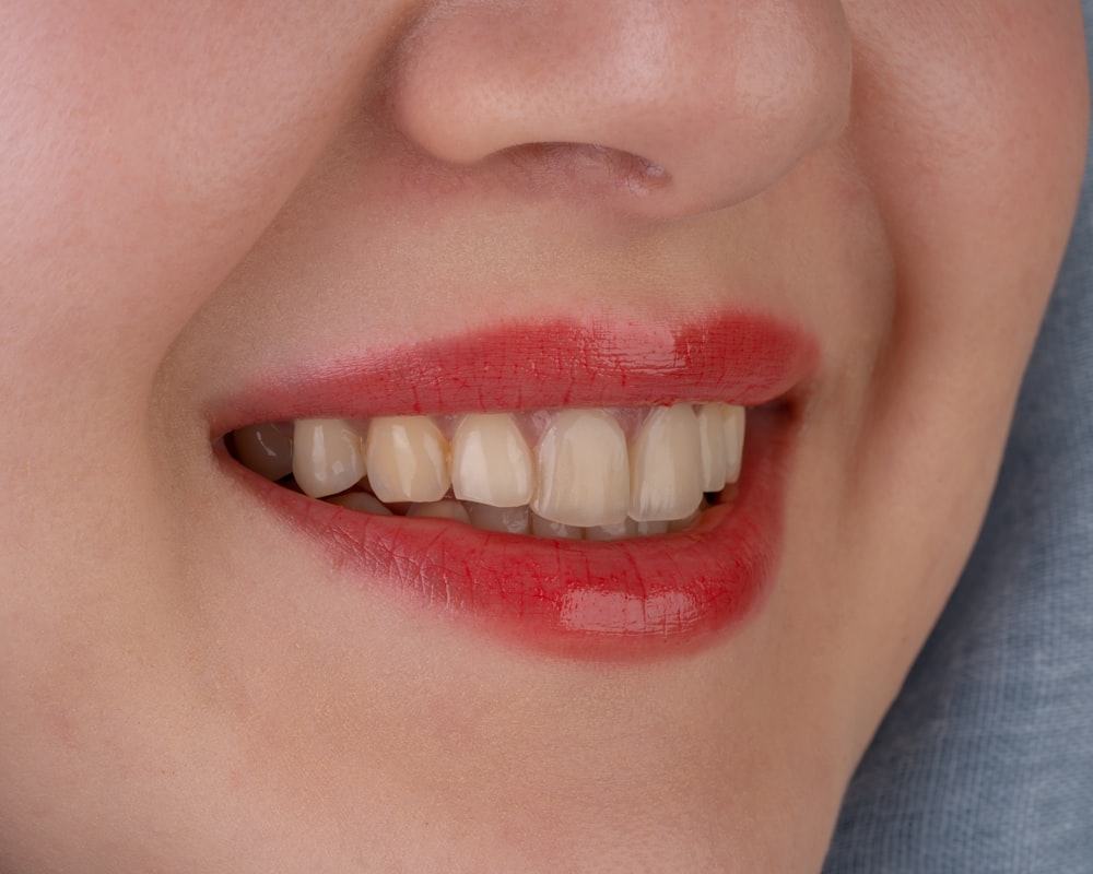 a close up of a person's mouth with a missing tooth