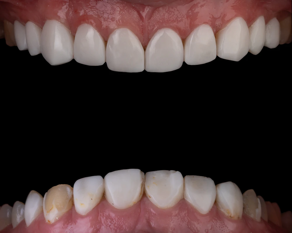 Sample illustration of teeth before treatment
