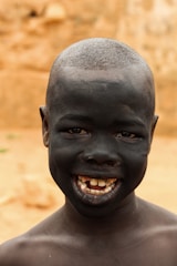 An adult with facial disfigurement smiling proudly after a makeover.