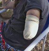 A person is sitting on a chair, wearing a black shirt and colorful patterned pants. Their right arm is amputated and wrapped with a beige bandage or cover. The setting seems to be outdoors, possibly in a garden or patio area.