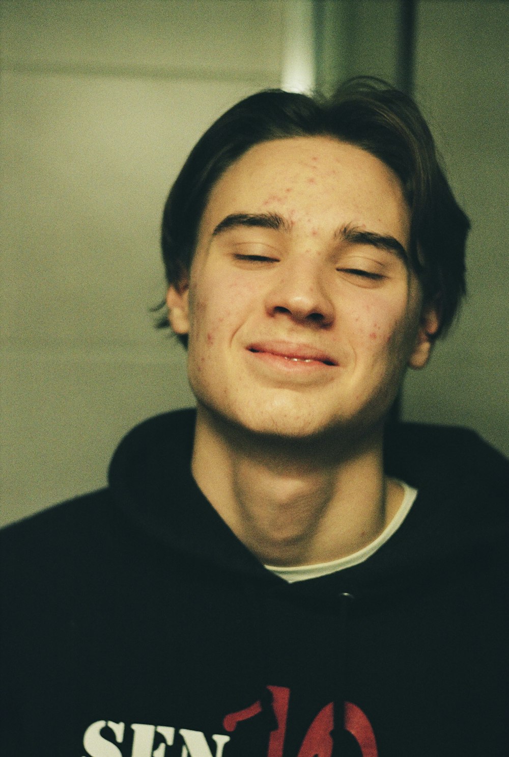 a young man with freckles on his face