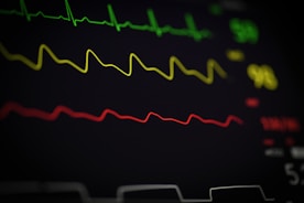 a close up of a computer screen with a line of ecg