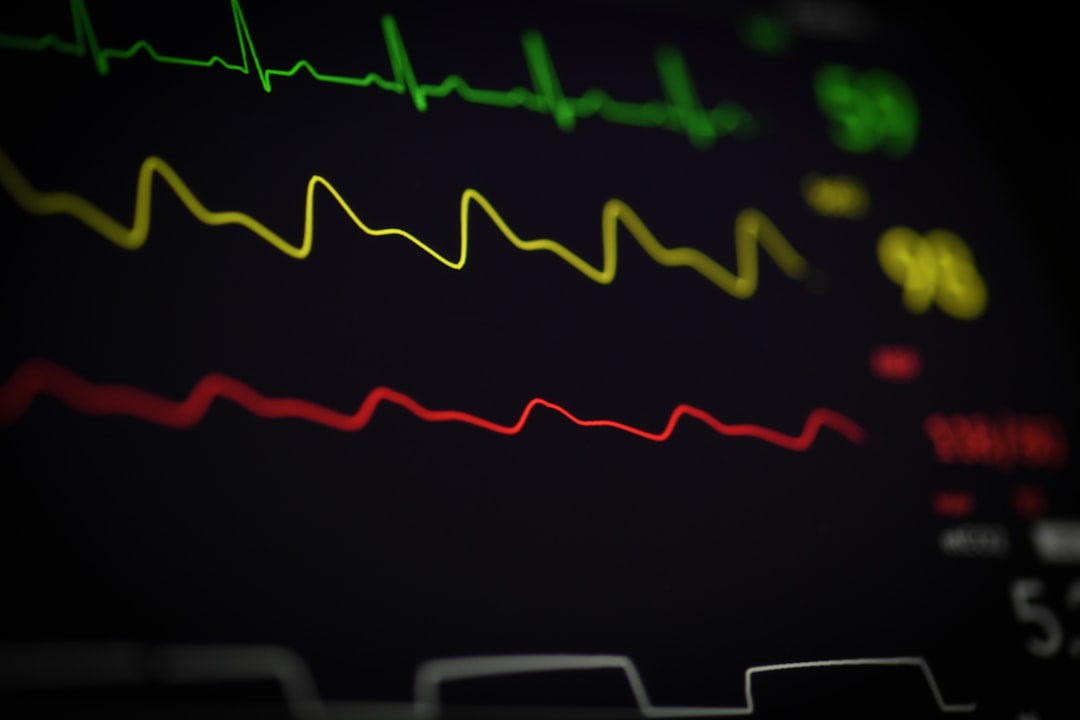 a close up of a computer screen with a line of ecg