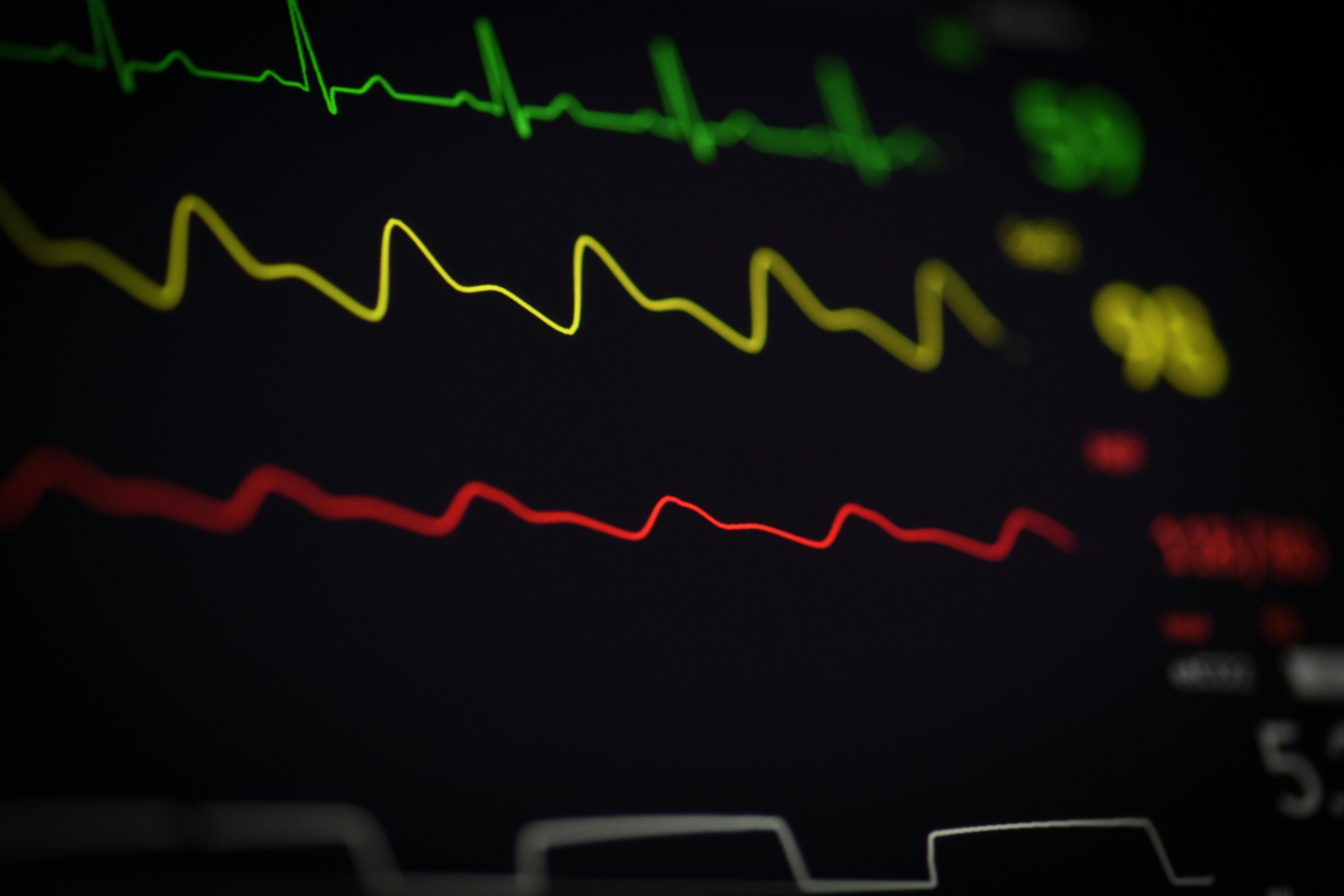 Beyond the Smartwatch: Why Heart Rate Variability Is the True Measure of Your Nervous System's Resilience
