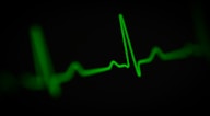 a green heart beat on a black background