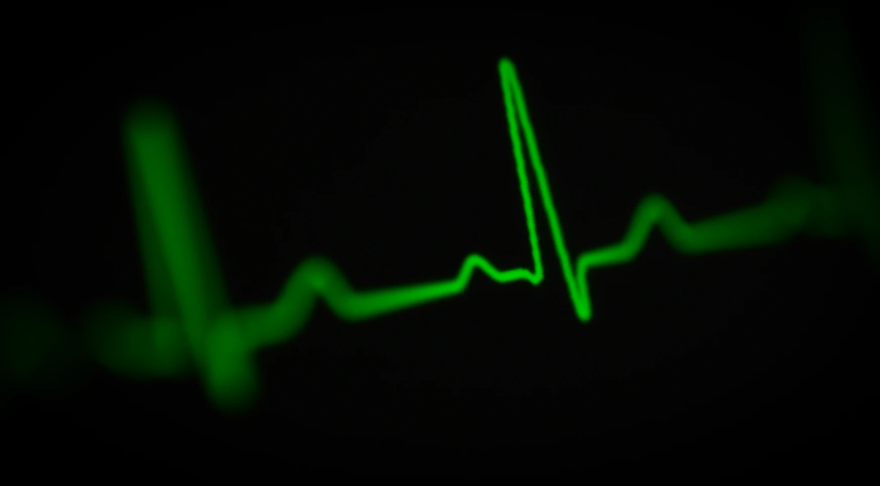 ECG Signal — Heart Rate Monitor