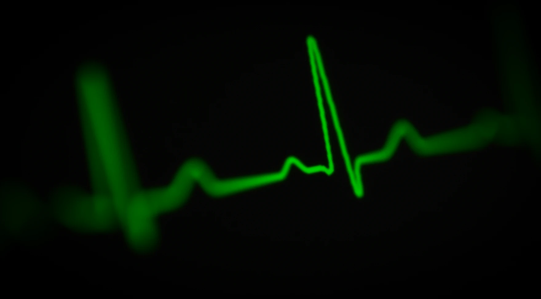 What HRV Actually Is, And Why It Matters for POTS Recovery