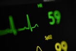 Detailed view of an electrocardiogram (EKG) monitor displaying heart rate and oxygen saturation levels. The heart rate is shown as 59 beats per minute, and an EKG waveform is visible. The SpO2 level is displayed in yellow.