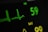 Detailed view of an electrocardiogram (EKG) monitor displaying heart rate and oxygen saturation levels. The heart rate is shown as 59 beats per minute, and an EKG waveform is visible. The SpO2 level is displayed in yellow.