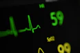a close up of a clock with a heartbeat on it
