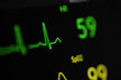 a close up of a clock with a heartbeat on it
