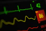 Close-up of a heart monitor displaying a heartbeat rhythm.