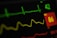 A close-up view of a digital medical monitor displaying vital signs including a green electrocardiogram (ECG) line, a yellow respiratory rate line, and numerical values with a red background indicating a concerning level.