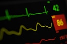 Close-up of an ECG monitor displaying a clear heart rhythm graph in a calm medical setting.
